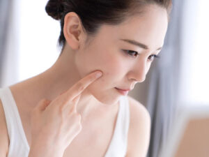 歯列矯正中に肌荒れする原因って？その意外な理由