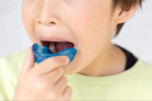 子供の歯科矯正は補助金の対象になる？かかる費用や保険適用の有無を解説