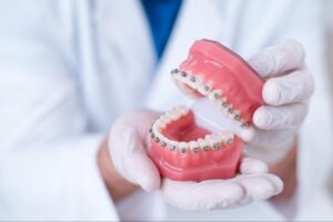 歯科矯正は保険適用になる？条件や費用相場、支払いの負担を軽減する方法を解説