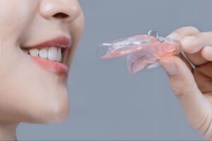 歯科矯正後のリテーナーは一生必要？必要な期間と後戻りを防ぐ工夫を解説